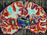 Brain Section, Cerebellum Section Photographie