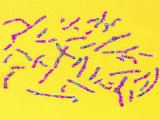 Human Chromosomes Normal Karyotype Photographie