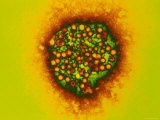 Hepatitis A Viruses X225,000 Photographic Print