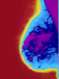 Pseudocolored X-Ray Female Breast Showing Density Photographic Print