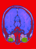 Brain Hemispheres Colorized MRI Normal Photographic Print