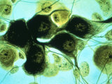 Neurons by Brightfield Microscope Photographic Print
