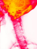 Neck Cervical Spine X-Ray Enhanced Skull Head Fotografisk tryk