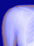 X Ray Shoulder Outline of Skin Visible Fotografie-Druck