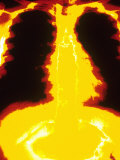 Normal Chest X-Ray Photographic Print