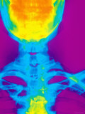 Enhanced X-Ray Normal Cervical Spine, Apex Lung Photographie