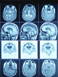 Blue Rows of Cat Scan Images of the Brain Photographic Print Blue Rows of Cat Scan Images of the Brain Photographic Print