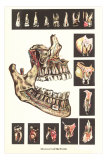 Diseases of the Teeth Posters