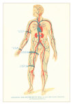 Where to Put the Tourniquet Poster