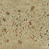 Alzheimer's Disease. Light Micrograph Showing Both Neurofibrillary Tangles and Plaques Photographic Print by Thomas Deerinck