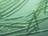 Anabaena Cyanobacteria with Heterocysts Photographic Print by Sherman Thomson