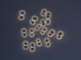 Living Eucapsis Cyanobacteria. Phase Contrast Photographic Print by Michael Abbey