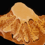Podocyte Cells on a Glomerulus in the Kidney Photographic Print by Wolf Fahrenbach
