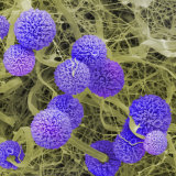Aspergillus Niger Mold Fruiting Bodies (Conidiophores or Sporangia) and Hyphae Photographie par Fred Hossler