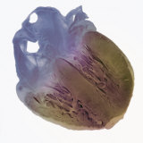 Vertical Section Through the Heart from the Front Photographic Print by Ralph Hutchings