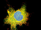 Fluorescent Confocal View of Hela Cell Photographic Print by Gopal Murti