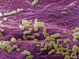 A Variety of Bacteria on the Surface of Human Skin Photographic Print by David Phillips