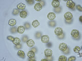 Sphaerocystis Cyanobacteria Photographic Print by Robert Calentine