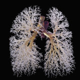 Resin Cast of Lungs, Bronchi Only, Anterior View Photographic Print by Ralph Hutchings