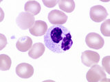 Leukocyte in a Blood Smear from a Human Male Without a Drumstick. Brightfield Photographie par Michael Abbey