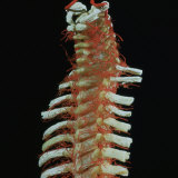 Human Cadaver Dissection Showing the Arteries of the Vertebral Column Fotografisk trykk av L. Bassett
