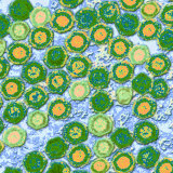 Herpes Viruses Photographic Print by George Musil