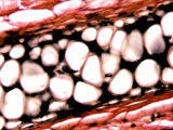 Elastic Cartilage in the Ear Photographic Print by Robert Calentine