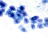Giardia Lamblia Protozoa. Brightfield Photographie par Michael Abbey