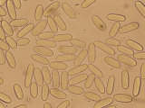 Spores of the Devil's Urn Mushroom, Urnula Craterium Photographic Print by Dana Richter