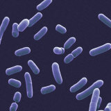 Haemophilus Influenzae Lámina fotográfica por David Phillips Haemophilus Influenzae Lámina fotográfica por David Phillips