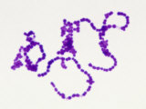 Streptococcus Pyogenes Bacteria, Gram-Positive Cocci. Brightfield Photographic Print by Michael Abbey
