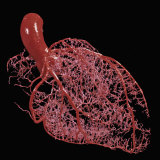 Resin Cast of Heart Showing Coronary Arteries Photographic Print by Ralph Hutchings