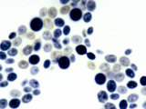 Budding Yeast (Saccharomyces Cerevisiae). Brightfield Photographie par Michael Abbey