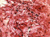 Dense Connective Tissue with Collagen and Elastic Fibers Photographic Print by Robert Calentine