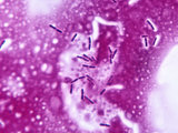 Lactobacillus Bulgaricus Bacteria in Yogurt Photographic Print