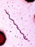 Borrelia Burgdorferi Bacteria, the Pathogen That Causes Lyme Disease Photographie par Michael Abbey