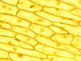 Onion Cells with Visible Nuclei, Iodine Stain Photographic Print by Kevin & Betty Collins