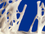 Spicules of Spongy or Cancellous Bone Femur Photographic Print by Robert Calentine