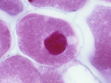 Nitrogen-Fixing Bacteria (Rhizobium Leguminosarum) in Legume Root Cells Photographie par Michael Abbey