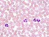 Human Blood Smear Showing Red Blood Cells or Erythrocytes and White Blood Cells or Leukocytes Photographic Print by Gopal Murti