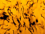 Treponema Pallidum Bacteria in Tissue, the Pathogen That Causes Syphilis Photographic Print by John D. Cunningham