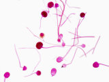 Rhizopus Mold Sporangia Lámina fotográfica Rhizopus Mold Sporangia Lámina fotográfica
