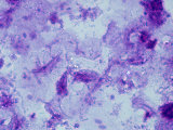 Human Oral Bacteria. Phase Contrast Photographie par Michael Abbey