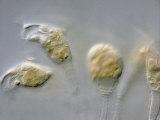 The Stalked Protozoan Epistylis. Dic Photographic Print by Robert Markus