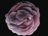 Human Fibroblast Cells Growing on a Microcarrier, Sephadex, Bead Photographie par David Phillips