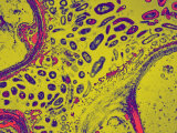 Nitrogen-Fixing Bacteria, Rhizobium, in Pea, Pisum, Root Cells Photographic Print by David Phillips