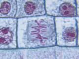 Metaphase Stage of Onion Mitosis (Allium) Photographie