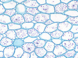 Buttercup, Ranunculus, Plant Root Cortex Parenchyma with Starch Grains Photographic Print by Ken Wagner