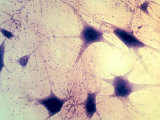 Multipolar Neurons Photographic Print by David Phillips