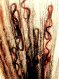 Nematode Worms, Philometroides, in a Fish Fin Photographic Print by Robert Calentine